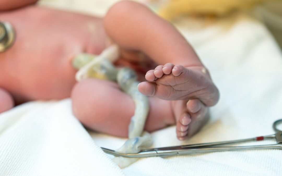 The intersection of delayed cord clamping and newborn stem cell preservation